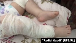 Жасқа толған Мудассир Каримов денесіндегі инені суырып алған отадан кейін