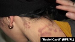 Полиция қамауына түскен душанбелік әйел жарақатын көрсетіп тұр. Көрнекі сурет